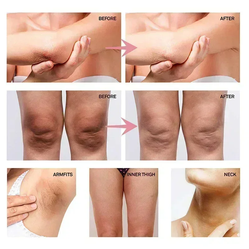 Collagen Underarm Whitening Cr - Anti-Aging Face Cream 评论和价格