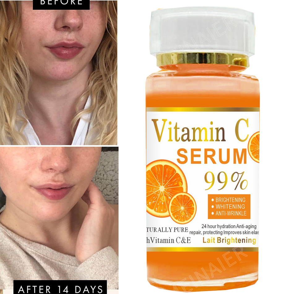 Super 120ml Vitamin C Serum An - Vitamin C Serum Face 评论和价格