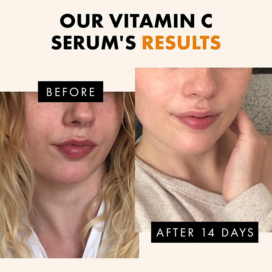 Super 120ml Vitamin C Serum An - Vitamin C Serum Face 评论和价格